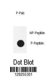 Anti-Phospho-AKT1 (T450) Antibody