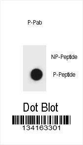 Anti-Phospho-Belcin 1 Antibody