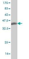 Anti-GOLGB1 Antibody