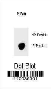 Anti-Phospho-BAD (S74) Antibody