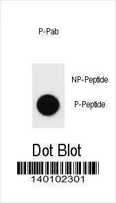 Anti-Phospho-ERBB2 (S1107) Antibody