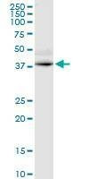 Anti-GPRC5D Antibody