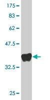 Anti-GPRC5D Antibody