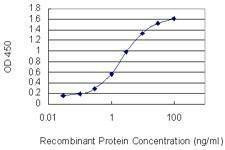 Anti-GPRC5D Antibody
