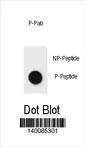 Anti-Phospho-ERBB2 (Y1196) Antibody