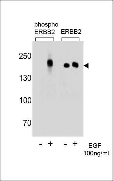 Anti-Phospho-ERBB2 (Y1196) Antibody