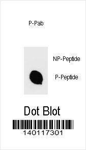 Anti-Phospho-IKKB (S670) Antibody