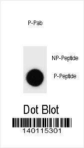 Anti-Phospho-IKKB (S689) Antibody