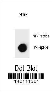 Anti-Phospho-IKKB (S697) Antibody