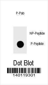 Anti-Phospho-IKKB (S672) Antibody