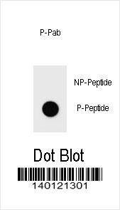 Anti-Phospho-IKKB (S682) Antibody
