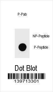 Anti-Phospho-KIT (S821) Antibody