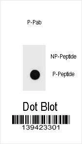 Anti-Phospho-KIT (T718) Antibody