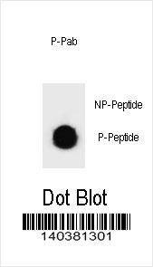 Anti-Phospho-KIT (Y570) Antibody