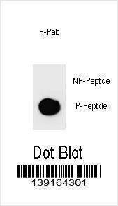 Anti-Phospho-PARP1 (S274) Antibody