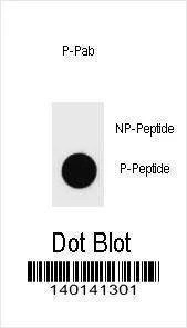 Anti-Phospho-PARP1 (T373) Antibody