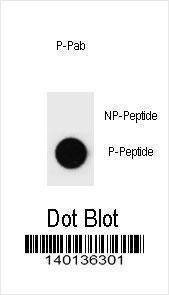 Anti-Rat Phospho-rat PARP1 (S373) Antibody
