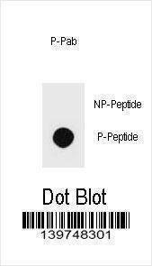 Anti-Phospho-PTEN (S229) Antibody