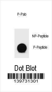 Anti-Phospho-PTEN (T366) Antibody