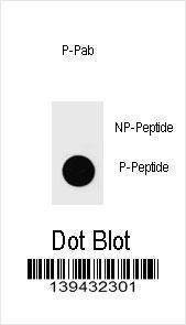 Anti-Phospho-PTEN (T401) Antibody