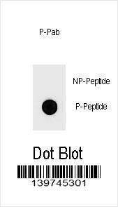 Anti-Phospho-PTEN (Y174) Antibody