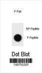 Anti-Phospho-ULK1 (S317) Antibody