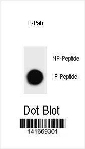 Anti-Mouse Phospho-mouse TSC1 (S594) Antibody
