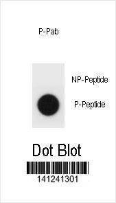 Anti-Mouse Phospho-mouse TSC1 (T1043) Antibody