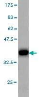 Anti-GRM6 Antibody