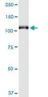 Anti-GRM6 Antibody