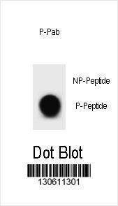 Anti-Phospho-bcl-2 (T56) Antibody