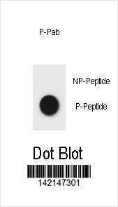 Anti-Phospho-CCNB2 (S22) Antibody