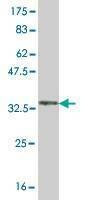 Anti-GRM8 Antibody