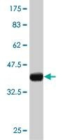 Anti-GSC Antibody