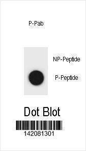 Anti-Mouse Phospho-mouse CCNB2 (S392) Antibody