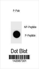 Anti-Mouse Phospho-mouse CCNB3 (S1063) Antibody