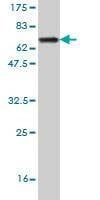 Anti-GSDML Antibody