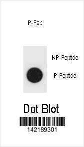 Anti-Mouse Phospho-mouse TSC1 (T416) Antibody