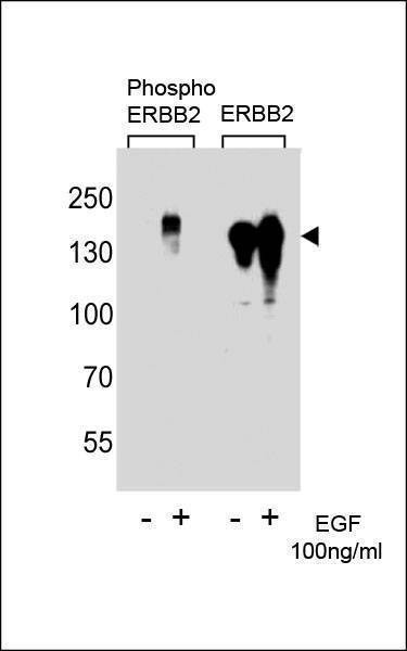 Anti-Phospho-ErbB2 (Y1222) Antibody