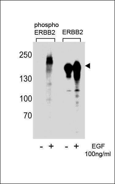 Anti-Phospho-ErbB2 (Y1222) Antibody