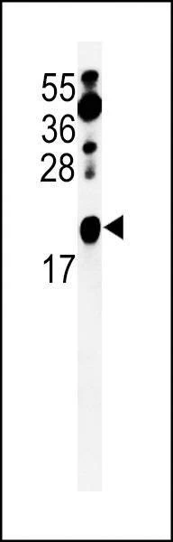 Anti-ZNF9 (Center) Antibody