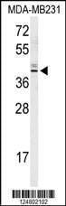 Anti-KLDC2 (C-term) Antibody