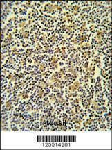 Anti-CORO6 (C-term) Antibody