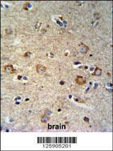 Anti-SETD6 (C-term) Antibody