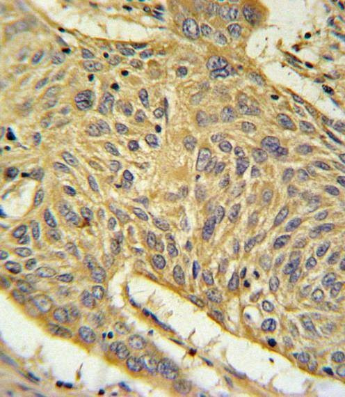 Anti-AGER (N-term) Antibody
