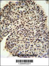 Anti-PRPF19 (N-term) Antibody