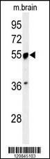 Anti-PRPF19 (N-term) Antibody