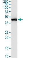 Anti-GTF2E1 Antibody