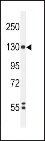 Anti-HIF1A Antibody