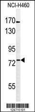 Anti-BBS10 (C-term) Antibody